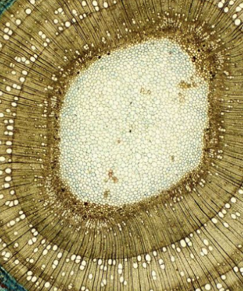 Microscopic view of plant tissue with concentric rings.